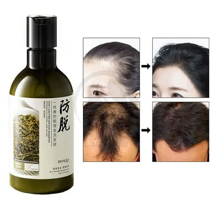 شامپو رزماری بیوآکوا (ضدریزش مو) ۲۵۰ میل